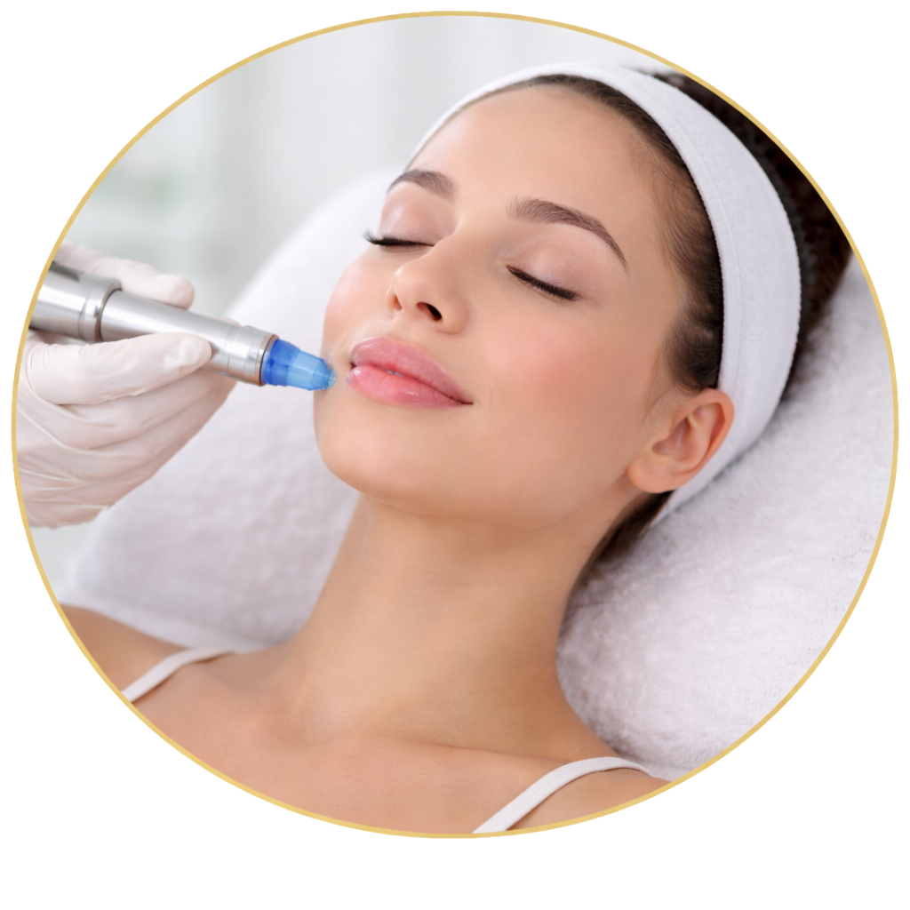 Microneedling